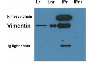 Immunoprecipitation of vimentin from HeLa cell lysate by antibody VI-10 (Vimentin 抗体)