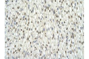 Rabbit Anti-TAF15 antibody         Paraffin Embedded Tissue:  Human Heart    cell Cellular Data:  cardiac cell    Antibody Concentration:  4.