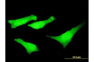 Immunofluorescence of monoclonal antibody to SYNE2 on HeLa cell. (SYNE2 抗体  (AA 6702-6799))