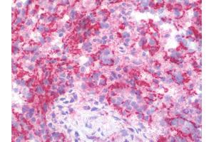 IHC with MAP3K11 antibody on frozen human spleen.