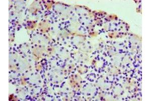 Immunohistochemistry of paraffin-embedded human pancreatic tissue using ABIN7142800 at dilution of 1:100 (RPL3 抗体  (AA 1-115))