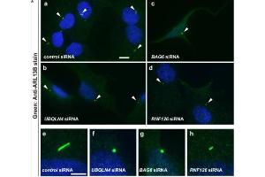 Confocal images from flat mount mouse retina samples at different postnatal ages showing the peripheral or central areas of RPE.