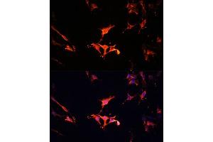 Immunofluorescence analysis of C6 cells using L Polyclonal Antibody (ABIN6133274, ABIN6143083, ABIN6143084 and ABIN6215309) at dilution of 1:100 (40x lens). (LAMTOR1 抗体  (AA 1-161))
