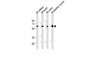 All lanes : Anti-Lyn Antibody (Center) at 1:2000 dilution Lane 1: mouse kidney lysates Lane 2: mouse heart lysates Lane 3: mouse ovary lysates Lane 4: mouse skeletal muscle lysates Lysates/proteins at 20 μg per lane. (LYN 抗体  (AA 229-263))