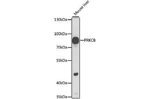 Western blot analysis of extracts of mouse liver, using PRKCB antibody (ABIN6290747) at 1:1000 dilution. (PKC beta 抗体)