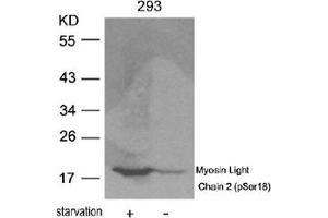 Image no. 2 for anti-Myosin, Light Chain 2, Regulatory, Cardiac, Slow (MYL2) (pSer18) antibody (ABIN319223) (MYL2 抗体  (pSer18))
