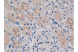 DAB staining on IHC-P; Samples: Rat Kidney Tissue (ALOX15B 抗体  (AA 349-633))