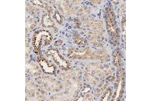 Immunohistochemical staining of human kidney with FMNL3 polyclonal antibody  shows moderate granular cytoplasmic positivity in cells of tubules at 1:200-1:500 dilution. (Formin-Like 3 抗体)