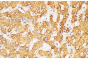 Immunohistochemistry of paraffin-embedded Human liver using FGB Polycloanl Antibody at dilution of 1:200 (Fibrinogen beta Chain 抗体)
