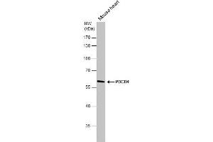 WB Image PDCD4 antibody detects PDCD4 protein by western blot analysis. (PDCD4 抗体)