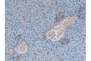 Detection of S100A6 in Rat Liver Tissue using Polyclonal Antibody to S100 Calcium Binding Protein A6 (S100A6)