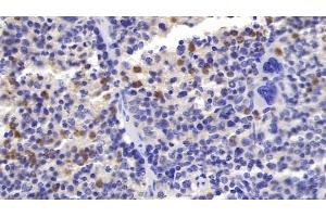 Detection of FceRI in Mouse Spleen Tissue using Polyclonal Antibody to Receptor I For The Fc Region Of Immunoglobulin E (FceRI) (Fc epsilon RI/FCER1A 抗体  (AA 24-204))