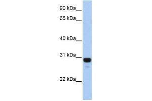 WB Suggested Anti-AMN1 Antibody Titration: 0. (AMN1 抗体  (N-Term))
