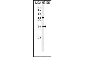 Western blot analysis of FOXE3 / FKHL12 Antibody (Center) in MDA-MB435 cell line lysates (35ug/lane). (FOXE3 抗体  (Middle Region))