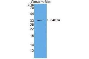 Detection of recombinant PCDH15 using Polyclonal Antibody to Protocadherin 15 (PCDH15) (PCDH15 抗体)