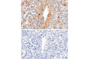 IHC testing of FFPE human adrenal gland tissue with VMAT2 antibody at 2. (SLC18A2 抗体)