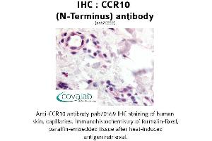 Image no. 1 for anti-Chemokine (C-C Motif) Receptor 10 (CCR10) (N-Term) antibody (ABIN1732760) (CCR10 抗体  (N-Term))