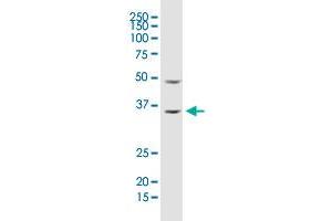 ARHGDIA monoclonal antibody (M02), clone 1G5-2F3. (ARHGDIA 抗体  (AA 1-204))