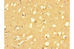 Immunohistochemistry of paraffin-embedded human brain tissue using ABIN7154600 at dilution of 1:100