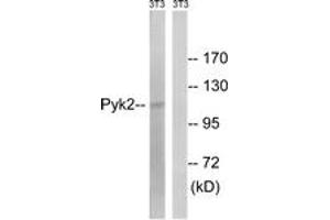 Western blot analysis of extracts from NIH-3T3 cells, using PYK2 (Ab-579) Antibody.