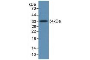 Detection of Recombinant C5a, Human using Monoclonal Antibody to Complement Component 5a (C5a) (C5A 抗体  (AA 678-751))