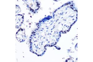 Immunohistochemistry of paraffin-embedded human placenta using STB Rabbit pAb (ABIN6133917, ABIN6148579, ABIN6148580 and ABIN6215957) at dilution of 1:100 (40x lens). (STAT5B 抗体  (AA 1-100))