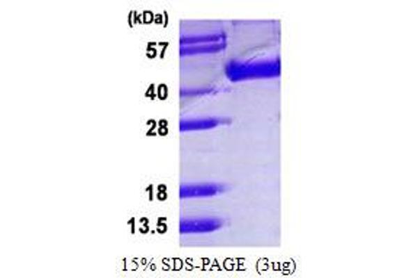 Influenza Hemagglutinin HA1 Chain (HA1) protein (His tag)