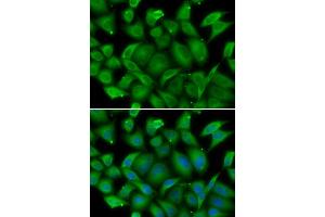 Immunofluorescence analysis of HeLa cell using DEFA1 antibody. (alpha Defensin 1 抗体)