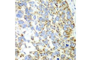 Immunohistochemistry (Paraffin-embedded Sections) (IHC (p)) image for anti-Chitinase, Acidic (CHIA) (AA 1-368) antibody (ABIN1679217)
