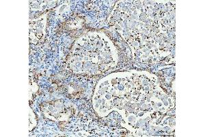 IHC analysis of Aquaporin 4 using anti-Aquaporin 4 antibody (ABIN3043789). (Aquaporin 4 抗体  (C-Term))