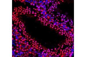 Immunofluorescence (Paraffin-embedded Sections) (IF (p)) image for anti-Poly A Binding Protein Nuclear 1 (PABPN1) antibody (ABIN7075116)
