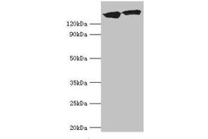 Western blot All lanes: DCTN1 antibody at 20 μg/mL Lane 1: Mouse brain tissue Lane 2: Jurkat whole cell lysate Secondary Goat polyclonal to rabbit IgG at 1/10000 dilution Predicted band size: 142, 128, 137, 139, 127, 141 kDa Observed band size: 142 kDa (Dynactin 1 抗体  (AA 1084-1278))