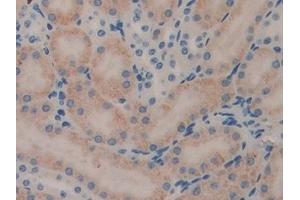 Detection of LEI in Mouse Kidney Tissue using Polyclonal Antibody to Leukocyte Elastase Inhibitor (LEI) (SERPINB1 抗体  (AA 184-368))