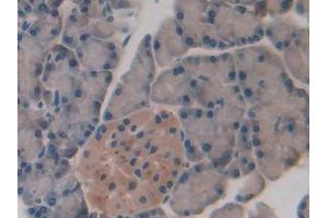 IHC-P analysis of Rat Pancreas Tissue, with DAB staining. (SLIT1 抗体  (AA 3-112))