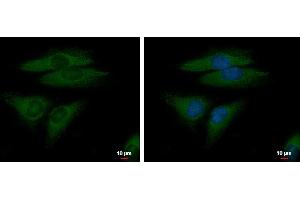ICC/IF Image FGFR-5 antibody detects FGFR-5 protein at cytoplasm by immunofluorescent analysis. (FGFRL1 抗体)