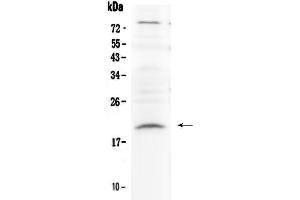Western blot analysis of Relaxin 1 using anti-Relaxin 1 antibody . (Relaxin 1 抗体)