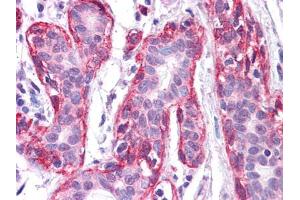 Immunohistochemical analysis of paraffin-embedded human Breast tissues using FRK mouse mAb. (FRK 抗体  (AA 2-300))
