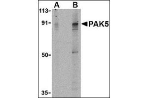 Western blot analysis of PAK5 in T24 lysate with this product at (A) 2 and (B) 4 μg/ml. (PAK7 抗体  (Center))