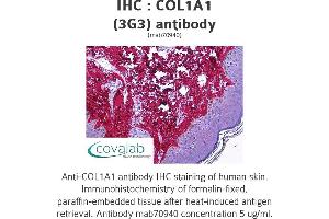 Image no. 1 for anti-Collagen, Type I, alpha 1 (COL1A1) (AA 1021-1108) antibody (ABIN1723789) (COL1A1 抗体  (AA 1021-1108))
