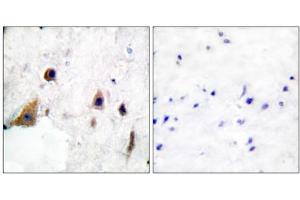 Immunohistochemical analysis of paraffin-embedded human brain tissue, using DARPP-32 (phospho-Thr75) antibody. (DARPP32 抗体  (pThr75))