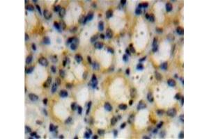 Used in DAB staining on fromalin fixed paraffin-embedded Kidney tissue (ADAMTS1 抗体  (AA 258-467))