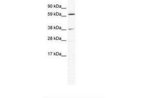 Image no. 1 for anti-ALX Homeobox 3 (ALX3) (N-Term) antibody (ABIN202290) (ALX3 抗体  (N-Term))