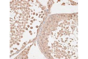 Immunohistochemistry of paraffin-embedded Rat testis using VEGF Receptor 2 Polyclonal Antibody at dilution of 1:100 (40x lens). (VEGFR2/CD309 抗体)