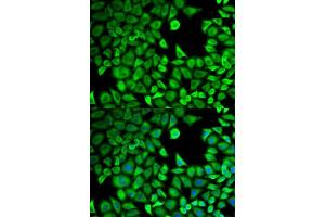 Immunofluorescence analysis of HeLa cells using LTA4H antibody. (LTA4H 抗体  (AA 312-611))