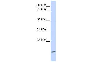 WB Suggested Anti-ZG16 Antibody Titration: 0. (ZG16 抗体  (Middle Region))
