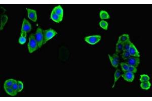 Immunofluorescent analysis of PC-3 cells cells using ABIN7175887 at dilution of 1:100 and Alexa Fluor 488-congugated AffiniPure Goat Anti-Rabbit IgG(H+L) (RPGR 抗体  (AA 1-180))