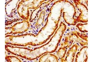 Immunohistochemistry of paraffin-embedded human kidney tissue using ABIN7167915 at dilution of 1:100 (ARHGAP1 抗体  (AA 216-308))