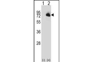 Western blot analysis of BTK (arrow) using rabbit polyclonal BTK Antibody (N-term) (ABIN657469 and ABIN2846497). (BTK 抗体  (N-Term))