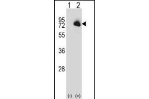 Western blot analysis of BTK (arrow) using rabbit polyclonal BTK Antibody (N-term) (ABIN657469 and ABIN2846497). (BTK 抗体  (N-Term))