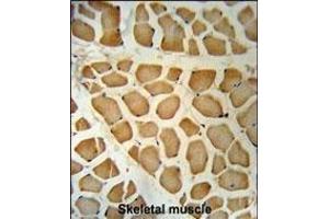 DHRS7 Antibody (N-term) (ABIN650968 and ABIN2840014) immunohistochemistry analysis in formalin fixed and paraffin embedded human skeletal muscle followed by peroxidase conjugation of the secondary antibody and DAB staining. (DHRS7 抗体  (N-Term))